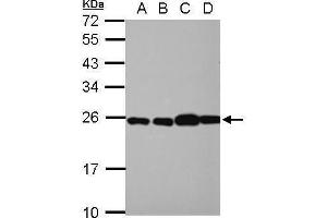 WB Image Sample (30 ug of whole cell lysate) A: NT2D1 B: PC-3 C: U87-MG D: SK-N-SH 12% SDS PAGE antibody diluted at 1:10000 (RPL29 anticorps)