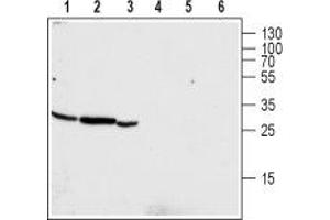 Western blot analysis of human pancreatic carcinoma PANC-1 (lanes 1 and 4), mouse kidney (lanes 2 and 5) and rat kidney (lanes 3 and 6) lysates: - 1-3. (CLIC4 anticorps  (Intracellular, N-Term))