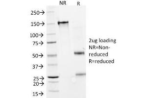 SDS-PAGE Analysis Purified IFNA2 Mouse Monoclonal Antibody (N27). (IFNA2 anticorps)