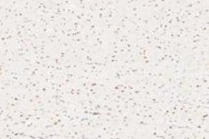 Immunohistochemistry analysis of paraffin-embedded rat heart using,APRIL (ABIN7072887) at dilution of 1: 1200