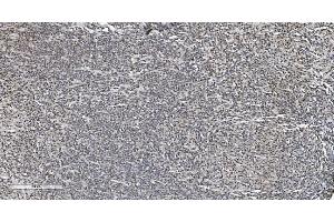 IHC analysis of HP1 alpha/CBX5 using anti-HP1 alpha/CBX5 antibody (ABIN7599057). (CBX5 anticorps  (AA 1-191))