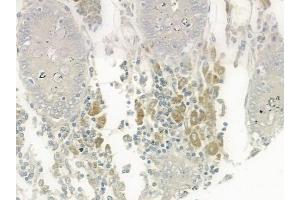 ABIN6259448 and ABIN6275352 at 1/100 staining human normal colon tissue by IHC-P. (PEX2 anticorps  (Internal Region))