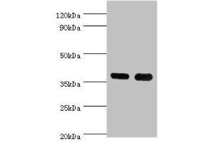 Western blot All lanes: CD1A antibody at 6 μg/mL Lane 1: K562 whole cell lysate Lane 2: Mouse thymus tissue Secondary Goat polyclonal to rabbit IgG at 1/10000 dilution Predicted band size: 37 kDa Observed band size: 37 kDa (CD1a anticorps  (AA 21-181))