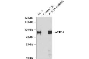 Immunoprecipitation analysis of 150 μg extracts of MCF7 cells using 3 μg A antibody (ABIN6131196, ABIN6137102, ABIN6137103 and ABIN6223591). (ARID3A anticorps  (AA 324-593))