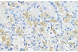 Immunohistochemistry of paraffin-embedded Mouse stomach using GPX2 Polyclonal Antibody at dilution of 1:100 (40x lens). (Glutathione Peroxidase 2 anticorps)