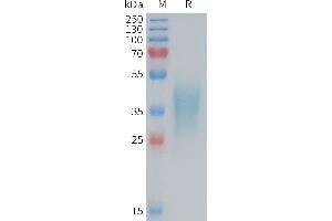 Mouse TNFB Protein, His Tag on SDS-PAGE under reducing condition.