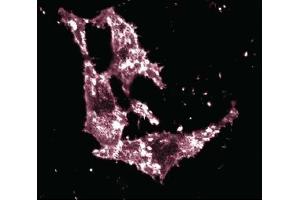 Immunofluorescent staining of HeLa cells. (Ezrin anticorps  (AA 391-515))