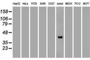 Western blot analysis of extracts (35 µg) from 9 different cell lines by using anti-CD2 monoclonal antibody. (CD2 anticorps)