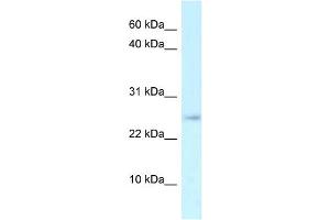WB Suggested Anti-Arpp21 Antibody   Titration: 1. (ARPP21 anticorps  (N-Term))