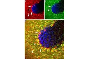 Expression of SSTR5 in mouse cerebellum - Immunohistochemical staining of Somatostatin receptor 5 (SSTR5) in mouse cerebellum using Anti-Somatostatin Receptor Type 5 (extracellular) Antibody (ABIN7043767 and ABIN7045267).
