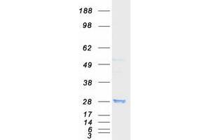 Validation with Western Blot