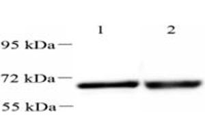 Western blot analysis of UCKL1 (ABIN7076157),at dilution of 1: 2000,Lane 1: HeLa cell lysate,Lane 2: Mouse kidney tissue lysate (UCKL1 anticorps)