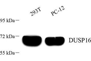 Western blot analysis of DUSP16 (ABIN7073775) at dilution of 1: 1000 (DUSP16 anticorps)