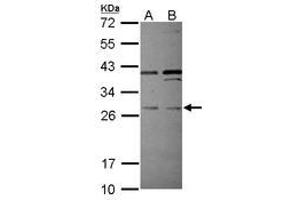 Image no. 2 for anti-Pleckstrin Homology Domain Containing, Family F (With FYVE Domain) Member 2 (PLEKHF2) (AA 60-249) antibody (ABIN1500276)