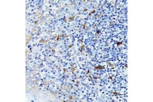 Immunohistochemistry of paraffin-embedded human tonsil using CTNNB1 antibody.