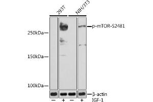 Western blot analysis of extracts of various cell lines, using Phospho-mTOR-S2481 (ABIN7268436) at 1:1000 dilution. (MTOR anticorps  (pSer2481))
