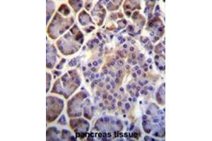 C6orf138 Antibody (Center) immunohistochemistry analysis in formalin fixed and paraffin embedded human pancreas tissue followed by peroxidase conjugation of the secondary antibody and DAB staining. (PTCHD4 anticorps  (Middle Region))