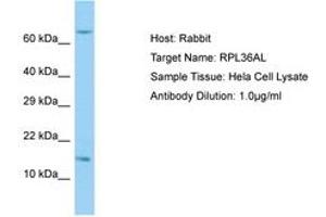 Image no. 1 for anti-Ribosomal Protein L36a-Like (RPL36AL) (C-Term) antibody (ABIN6749891) (RPL36AL anticorps  (C-Term))