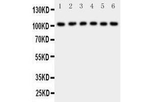 Western Blotting (WB) image for anti-Nuclear Factor of kappa Light Polypeptide Gene Enhancer in B-Cells 1 (NFKB1) (AA 778-797), (C-Term) antibody (ABIN3042654) (NFKB1 anticorps  (C-Term))