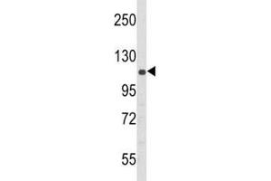 Western blot analysis of PERK antibody and 293 lysate