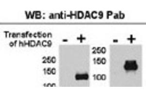 Western Blotting (WB) image for anti-Histone Deacetylase 9 (HDAC9) antibody (ABIN2996012) (HDAC9 anticorps)