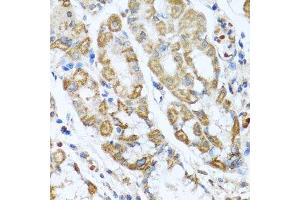 Immunohistochemistry of paraffin-embedded human stomach using ANTXR2 antibody. (ANTXR2 anticorps  (AA 339-488))