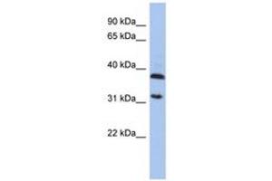 Image no. 1 for anti-Aspartoacylase (ASPA) (AA 143-192) antibody (ABIN6743963) (ASPA anticorps  (AA 143-192))