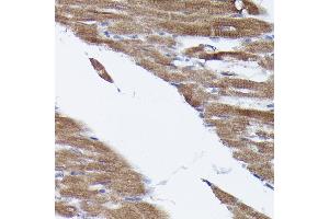 Immunohistochemistry of paraffin-embedded rat heart using [KO Validated] PHD2 Rabbit pAb (ABIN7266909) at dilution of 1:150 (40x lens). (EGLN1 anticorps  (AA 1-426))