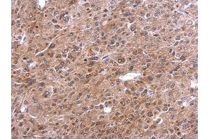 IHC-P Image TNFalpha-IP 2 antibody [C1C3] detects TNFalpha-IP 2 protein at cytosol on HeLa xenograft by immunohistochemical analysis.
