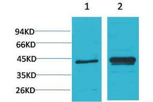Western Blotting (WB) image for anti-Nuclear Factor of kappa Light Polypeptide Gene Enhancer in B-Cells Inhibitor, alpha (NFKBIA) antibody (ABIN3188043) (NFKBIA anticorps)
