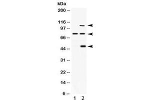 Western blot testing of 1) rat brain and 2) human 293 lysate with PACE4 antibody. (PCSK6 anticorps)
