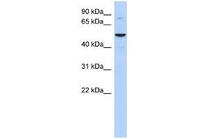 WB Suggested Anti-HTATIP Antibody Titration: 0. (KAT5 anticorps  (Middle Region))
