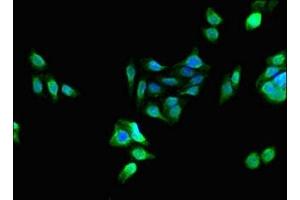 Immunofluorescent analysis of HepG2 cells using ABIN7163119 at dilution of 1:100 and Alexa Fluor 488-congugated AffiniPure Goat Anti-Rabbit IgG(H+L)