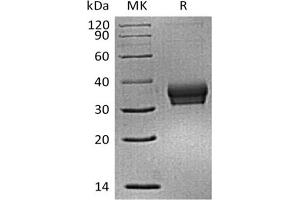 Western Blotting (WB) image for Sialic Acid Binding Ig-Like Lectin 15 (SIGLEC15) (Active) protein (His tag) (ABIN7320882)