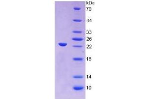 SDS-PAGE of Protein Standard from the Kit (Highly purified E.