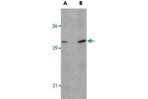 Western blot analysis of ATG12 in human brain tissue lysate with ATG12 polyclonal antibody  at (A) 0. (ATG12 anticorps  (N-Term))