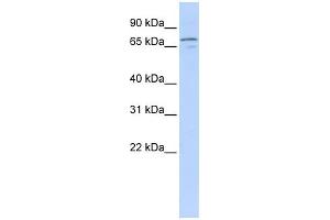 WB Suggested Anti-NRG3 Antibody Titration:  0. (Neuregulin 3 anticorps  (Middle Region))
