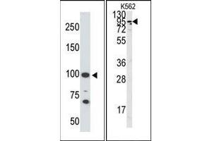 Image no. 1 for anti-Angiotensin I Converting Enzyme 2 (ACE2) (C-Term) antibody (ABIN358578) (ACE2 anticorps  (C-Term))