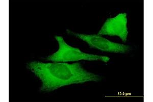 Immunofluorescence of purified MaxPab antibody to UNC45A on HeLa cell.