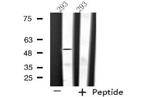 Western blot analysis of extracts from 293 cells using SLC39A7 antibody. (SLC39A7 anticorps  (Internal Region))