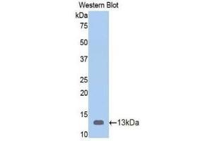 Western Blotting (WB) image for anti-Vitamin D-Binding Protein (GC) (AA 395-475) antibody (ABIN1078668) (Vitamin D-Binding Protein anticorps  (AA 395-475))