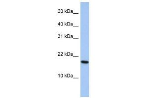 WB Suggested Anti-ARL5A Antibody Titration: 0. (ARL5A anticorps  (Middle Region))