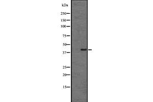 Western blot analysis of CMKLR1 expression in HL60 cell lysate ;,The lane on the left is treated with the antigen-specific peptide. (CMKLR1 anticorps  (Internal Region))