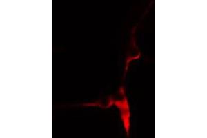ABIN6269003 staining HeLa cells by IF/ICC. (COL3A1 anticorps  (N-Term))
