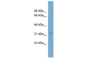 Western Blot showing KRCC1 antibody used at a concentration of 1-2 ug/ml to detect its target protein. (KRCC1 anticorps  (N-Term))