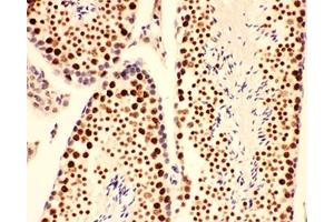 IHC-P testing of mouse testis tissue (BRCA1 anticorps  (AA 1661-1863))
