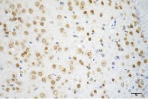 Immunohistochemistry was performed on paraffin-embedded mouse brain using chromodomain helicase DNA binding protein 3 antibody (ABIN7798068), 1:200). (Recombinant CHD3 anticorps)
