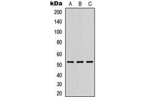 Western blot analysis of DMRTA1 expression in HEK293T (A), Raw264. (DMRTA1 anticorps  (Center))