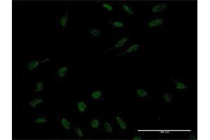 Immunofluorescence of monoclonal antibody to KLF10 on HeLa cell.