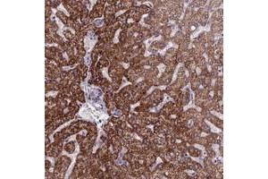 Immunohistochemical staining of human liver with FBRS polyclonal antibody  shows strong cytoplasmic positivity in hepatocytes at 1:20-1:50 dilution. (Fibrosin anticorps)